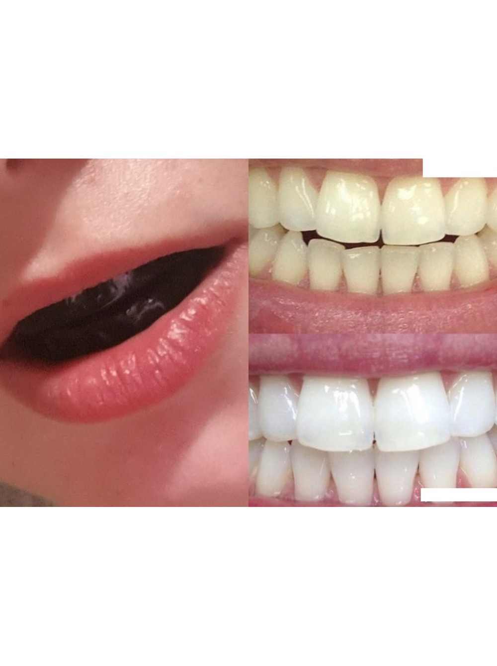 полоски для отбеливания зубов oral отзывы